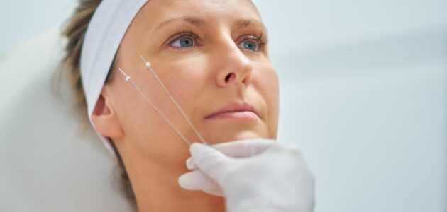 Is Thread Lift Safe