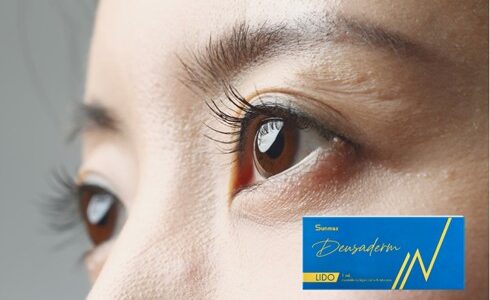 Fixing Dark Circles the Right Way