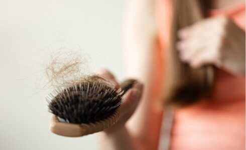 Which Hair Loss Treatment Is Right for You? A Complete Guide